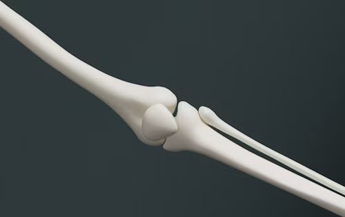 Orthopedics